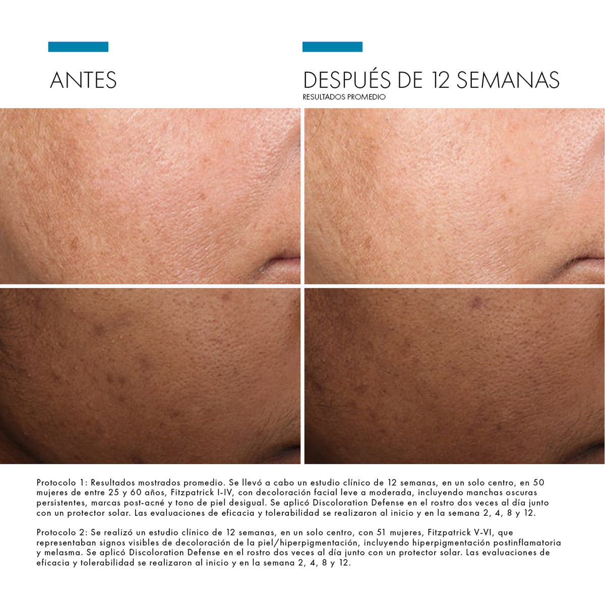 Discoloration Defense / Skinceuticals