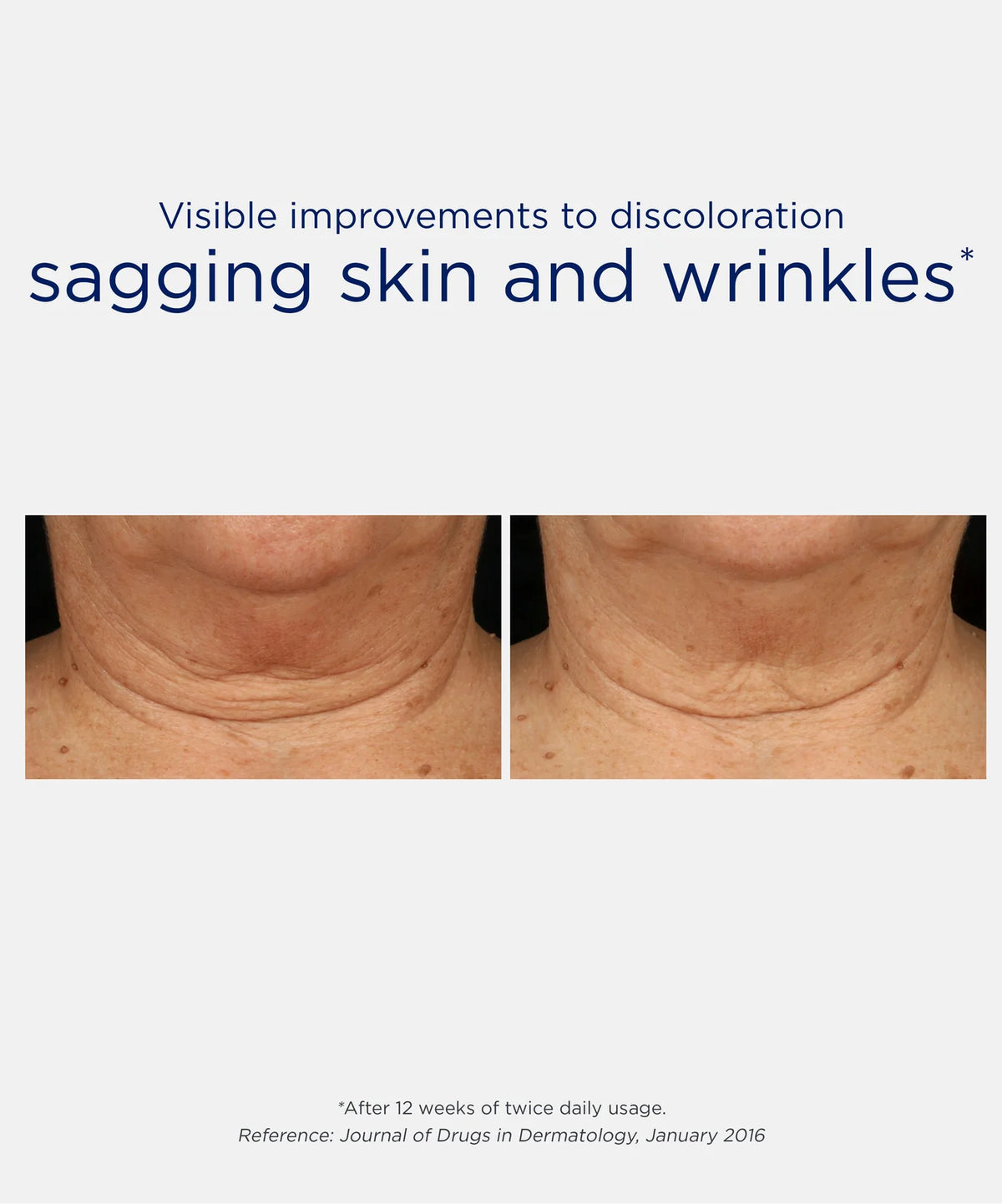 Triple Firming Neck