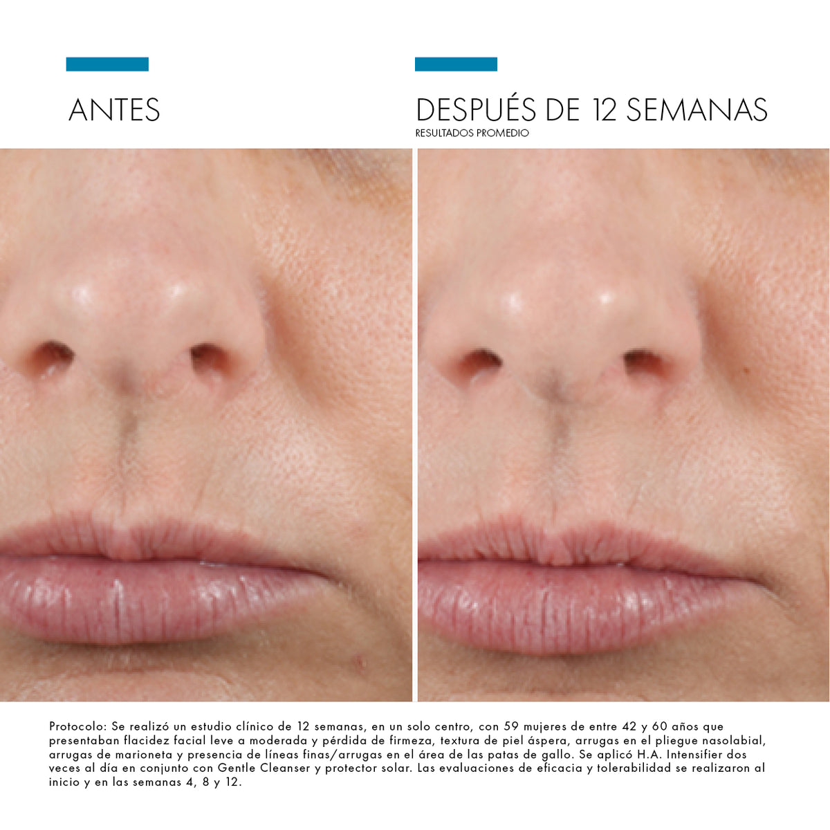 HA Intensifier / Skinceuticals