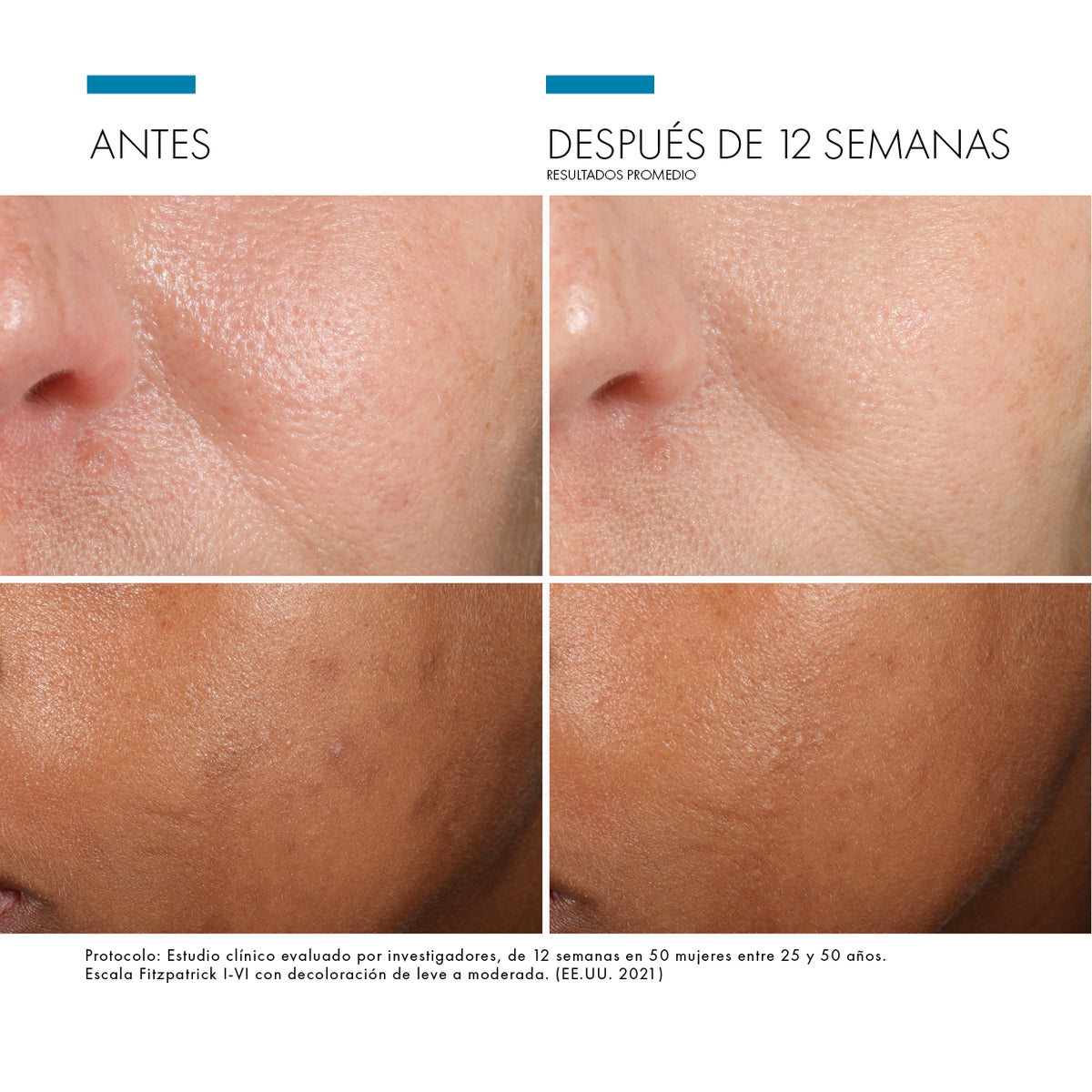 Phloretin CF® Sérum Vitamina C / Skinceuticals