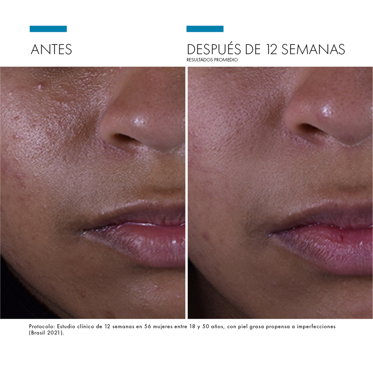 Silymarin CF / Skinceuticals