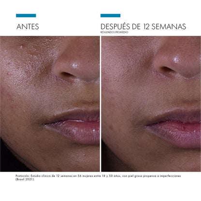 Silymarin CF / Skinceuticals